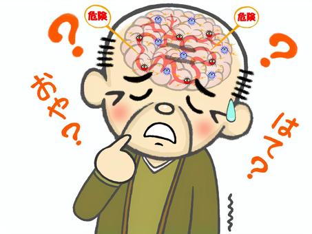 前頭側頭型認知症の画像①